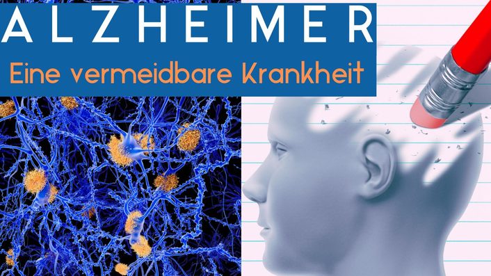 Video-Vorschaubild: Alzheimer – eine vermeidbare Krankheit